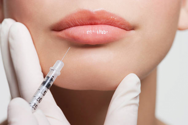 Aplicação de Botox e Preenchimento Consolação - Aplicação de Toxina Botulínica na Face Lapa