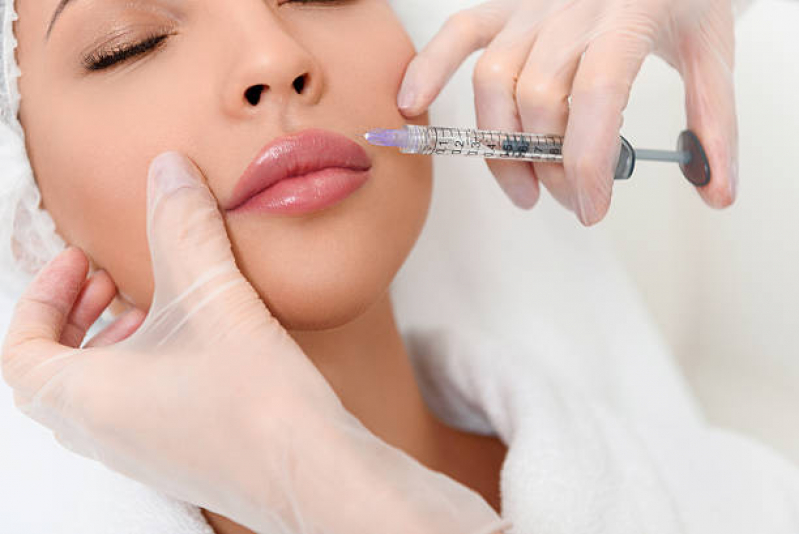 Aplicação de Botox no Bigode Chines Marcar Vila Uberabinha - Aplicação de Toxina Botulínica na Face Lapa