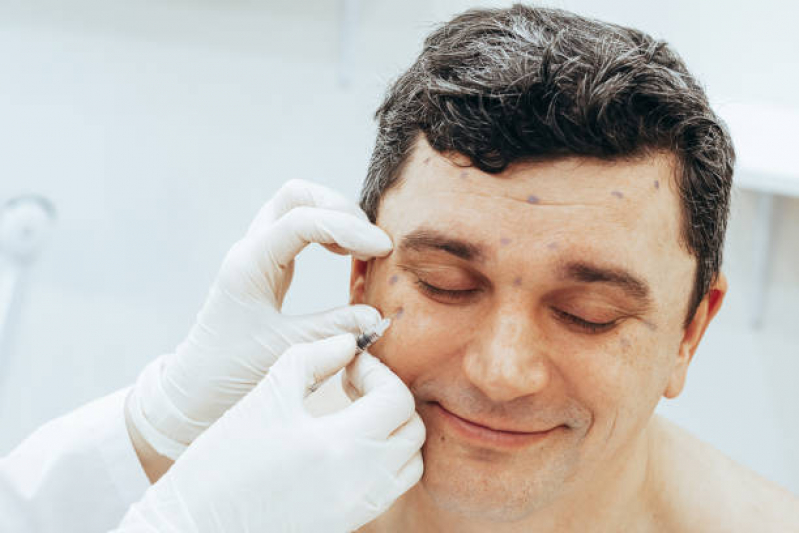 Aplicação de Toxina Botulínica na Face Buracão - Aplicação de Botox no Nariz Pompéia