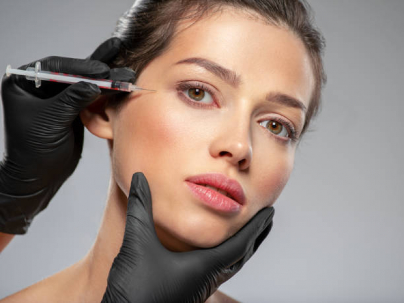 Clinica Que Faz Aplicação de Botox na Região dos Olhos Freguesia do Ó - Aplicação de Botox no Nariz Pompéia