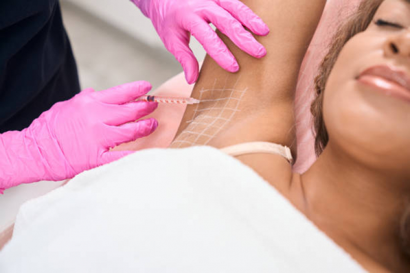 Clinica Que Faz Aplicação de Botox nas Axilas Vila Saúde - Aplicação de Toxina Botulínica na Face Lapa