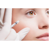 aplicação de botox na região dos olhos Tancredo Coutinho
