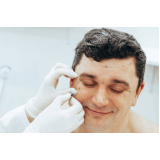 aplicação de toxina botulínica na face Siciliano