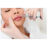 Aplicação de Botox nos Labios Pompéia
