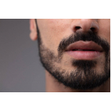 clínica de estética masculina limpeza de pele Vila Anastácio