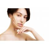 limpeza profunda de pele para acne agendar Bom Retiro