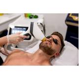 onde fazer depilação a laser masculina Mirandopólis